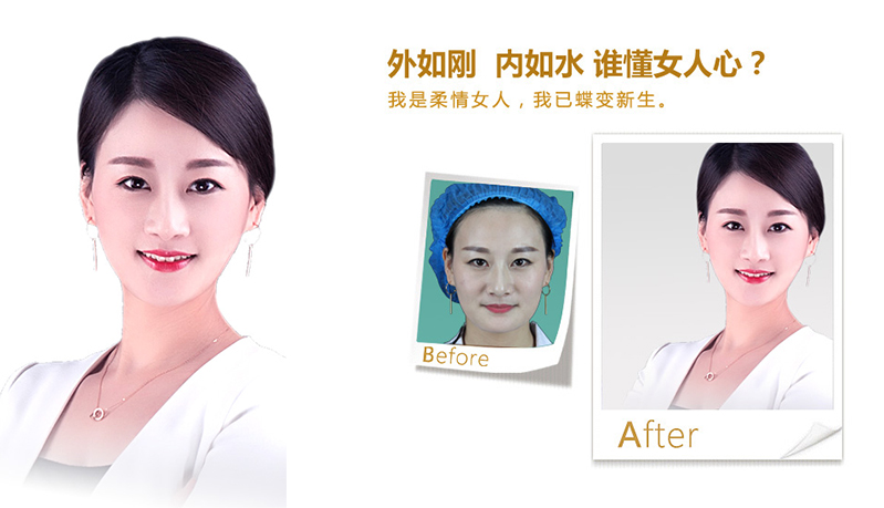 南通V脸、线雕隆鼻